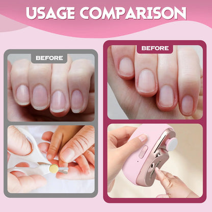 Smart Automatic Nail Clipper 2-in-1 – Professional Manicure at Home